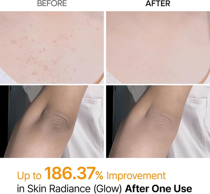 Dr.Melaxin - Peel Shot Kojic Acid Spray