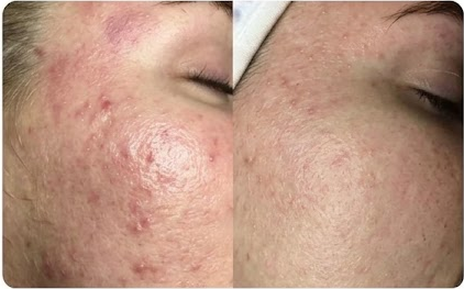 Dull Skin? Get a Fresher Look.