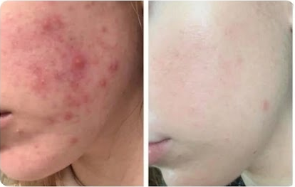 ✨ Uneven Skin? Get a More Refined Look.